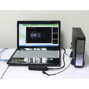 Escáner Oftálmico Económico ScanBox A-Scan con Biometría + Herramienta de Imagenología B-Scan, Modelo Económico EUS500T - Product Image 1