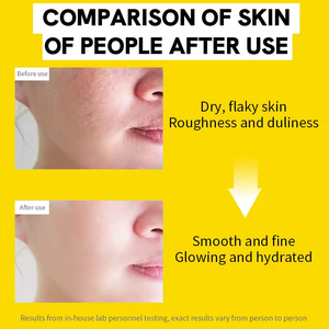 Exfoliante Corporal y Facial Orgánico al por Mayor para Limpieza Profunda, Blanqueamiento e Hidratación - Product Image 5