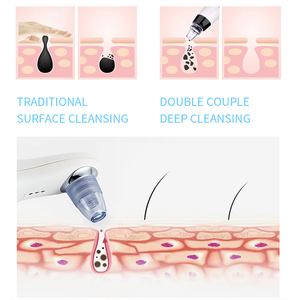 Outil d'aspiration des comédons portable à action rapide et efficace pour l'<span class=keywords><strong>extraction</strong></span> douce des points noirs et les soins de beauté du visage - Product Image 6
