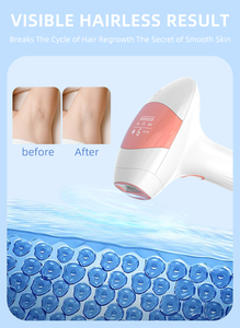 Sistema de Depilación IPL en Casa, Tecnología de Enfriamiento con Hielo Profesional y 999,900 Flashes Ilimitados para Resultados Permanentes - Product Image 5