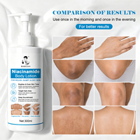 Lotion éclaircissante hydratante au beurre de karité 300 ml OEM, légère, unifiante, à la niacinamide, pour blanchir la peau