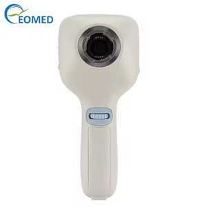 Caméra de fond d'œil portable populaire pour usage médical, équipement optique, caméra de fond d'œil portable la plus vendue HYDC100B - Product Image 5