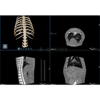 SY-W2920 Equipo de TC Veterinario de Grado Médico de Alto Rendimiento, TC Dinámica, DR en Tiempo Real, Fluoroscopia, DR Estática, Reconstrucción Panorámica Dental 3D