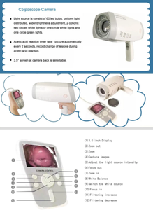 Instrumento de diagnóstico de enfermedades ginecológicas de colposcopia vaginal C6HD rentable recientemente desarrollado para hospital - Product Image 3