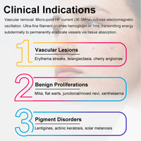 Appareil d'épilation par électrolyse 5 en 1 pour clinique esthétique, homologué CE ROHS, fréquence 36,5 MHz, pour l'élimination des poils gris, blancs et bruns