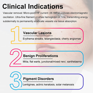 Appareil d'épilation par électrolyse 5 en 1 pour clinique esthétique, homologué CE ROHS, fréquence 36,5 MHz, pour l'élimination des poils gris, blancs et bruns - Product Image 5