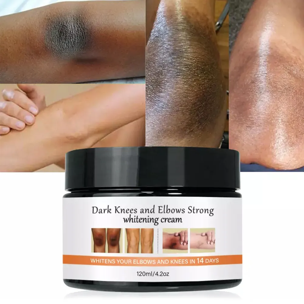 OEM Kojic एसिड क्रीम डार्क घुटनों और कोहनी मजबूत चमकती त्वचा 7 दिनों तेजी से कार्रवाई चरम Whitening क्रीम के लिए काले त्वचा