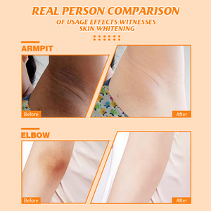 Sỉ nhà máy Hàn Quốc kem làm trắng khuỷu tay, nách, vùng kín và nách, dưỡng ẩm, khử mùi, OEM - Product Image 5