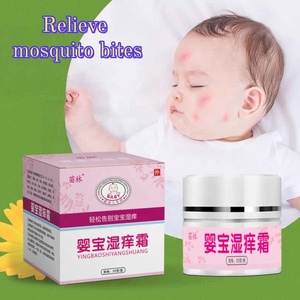 Crème anti-démangeaisons pour les infections fongiques, démangeaisons, teigne, eczéma cutané, crème apaisante pour bébé, 20g, formule douce à base de plantes - Product Image 3