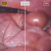 Système de caméra endoscopique laparoscopique électrique 4K de haute qualité IKEDA YKD-9210, étanche IPX8, instrument médical pour usage hospitalier