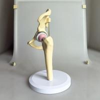 Modèle d'articulation de la hanche avec prothèse artificielle - Composants en PVC et métal ABS pour l'enseignement orthopédique