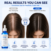Traitement nourrissant avancé pour la repousse des cheveux, huile capillaire au peptide de cuivre GHK-Cu AHK-Cu, formule 2-en-1 pour la croissance des cheveux, soin du cuir chevelu, plus épais