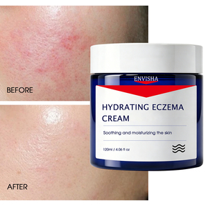 Crème hydratante bio très vendue pour réhydrater en profondeur, restaurer le confort cutané, nourrir la peau rugueuse, apaiser l'inconfort et soulager l'eczéma - Product Image 2