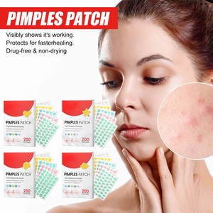 แผ่นแปะสิวคอลลาเจนสีสันสดใส 200 ชิ้น สำหรับกำจัดสิว บำรุงผิว ใช้เป็นเครื่องมือแต่งหน้า - Product Image 3