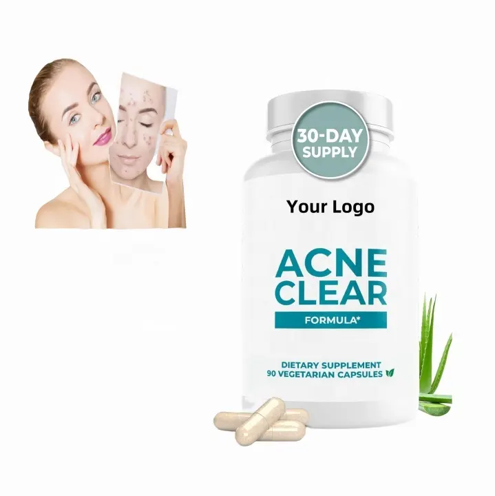 OEM, supplément contre l'acné pour soins de la peau, capsule de nettoyage anti-acné, capsule pour peau grasse, capsules de blanchiment de la peau contre les taches brunes