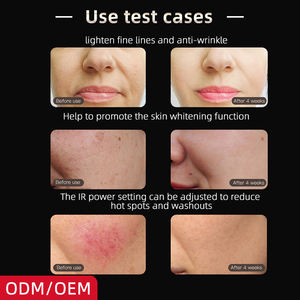 Masque de thérapie par lumière rouge pour la revitalisation de la peau du visage, thérapie par lumière rouge photonique, soin de la peau du visage, thérapie par lumière LED - Product Image 4