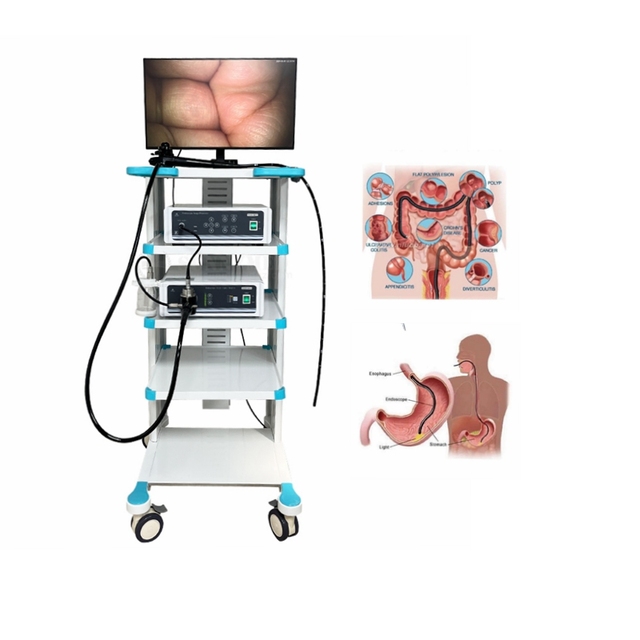 SY-PGC048 Surgical Navigation System  Medical Full HD Laparoscopy Tower for Rigid Endoscopy