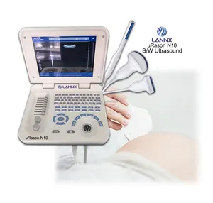 LANNX uRason N10医院门诊诊断使用超声系统回波照相机便携式超声扫描仪