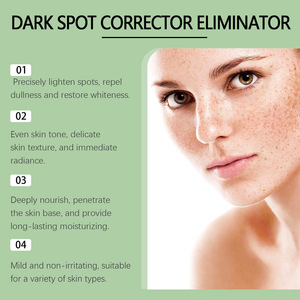 Crema OUHOE para Eliminar Manchas, Melasma, Imperfecciones, Crema Blanqueadora Fuerte para Eliminar Pecas y Corrector Facial - Product Image 3