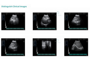 Échographe portable B17 Ecograf 2D, bon rapport qualité-prix, échographie numérique, échographie couleur Doppler portable - Product Image 3