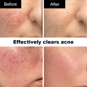 เซรั่มบำรุงผิวหน้า Luxfume Private Label ช่วยปรับผิวกระจ่างใส ลดเลือนริ้วรอย ซ่อมแซมผิวอย่างอ่อนโยน ลด<span class=keywords><strong>รอย</strong></span><span class=keywords><strong>สิว</strong></span> กระชับรูขุมขน - Product Image 2