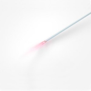 EVLT <span class=keywords><strong>Tratamiento</strong></span> 980nm 1470nm Equipo <span class=keywords><strong>de</strong></span> máquina <span class=keywords><strong>de</strong></span> láser <span class=keywords><strong>de</strong></span> vena varicosa Evlt endovenosa Fibra radial - Product Image 4