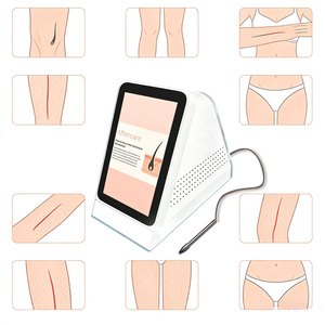 С помощью устройства для электроэпиляции вы можете получить точное удаление волос и заметно снизить плотность волос. - Product Image 1