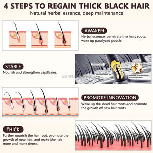 Atacado Private Label Natural Orgânico Herbal Ginger Biotina Anti Perda De Cabelo Impulsionando Soro De Crescimento Do Cabelo Rápido - Product Image 6