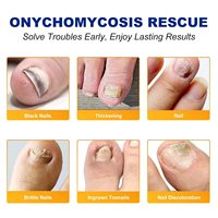 CL Offre Spéciale Système de Patchs de Gel Réparateurs pour Ongles, Marque Privée, Traitement des Ongles d'Orteil Abîmés et Fongiques, Durée de Vie de 2 Ans, Fabriqué à Guangdong
