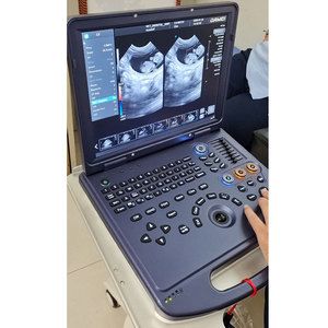 Máquina de Ultrasonido Portátil para Diagnóstico de Mascotas (Perros y Gatos) Dawei de Alta Sensibilidad con 6 Horas de Duración de Batería - Product Image 1