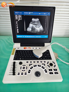 Deteksi cepat baterai tahan lama dokter hewan biaya rendah B <span class=keywords><strong>Ultrasound</strong></span> ringan cocok untuk Klinik dokter hewan kecil - Product Image 3