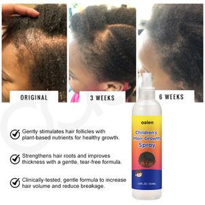 <span class=keywords><strong>Spray</strong></span> para el Crecimiento del Cabello para Niños de Marca Privada, Tratamiento Orgánico Natural para el Cuero Cabelludo, Sin Enjuague, Estimula el Cabello Fuerte y Saludable para Niños - Product Image 6