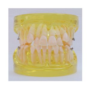 Modelo de estudio de dientes de ortodoncia dental 24 dientes - Product Image 3