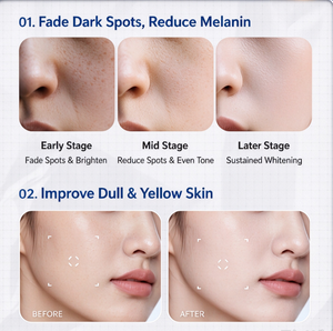 Suero Facial Blanqueador 377 al por Mayor, Esencia Aclarante para Manchas Oscuras, Ilumina la Piel, Hidratante, Suministro de Fábrica - Product Image 2