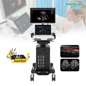 Ecógrafo Sonoscape P12 Elite, Máquina de Ultrasonido, Instrumentos Médicos de Ultrasonido para Hospitales - Product Image 1