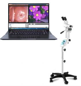 Kernel Ce aprobación tipo carro Digital óptico ginecología médica <span class=keywords><strong>endoscopia</strong></span> Video Colposcopio con cámara HD para clínica Hospital - Product Image 5