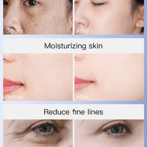 Private Label Facial <b>Kit</b> Niacinamide Lightening Cream Serum Moisturizer 4 in 1 <b>Skin</b> <b>Care</b> Set - Product Image 6