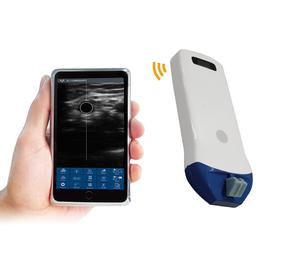 Sonda <span class=keywords><strong>de</strong></span> Ultrasonido Inalámbrica Lineal <span class=keywords><strong>Doppler</strong></span> Color <span class=keywords><strong>de</strong></span> 14 MHz y 128 Elementos USB, Instrumentos <span class=keywords><strong>de</strong></span> Ultrasonido Eléctricos, Sonda Ultrasónica para <span class=keywords><strong>Tiroides</strong></span> y Músculo-Esquelético - Product Image 1