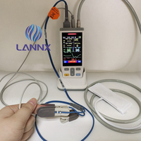 LANNX PC100 meilleure vente vétérinaire Pet multi-paramètres ECG Monitor Scanner Machine Animal 24 heures dynamique ECG Holter Monitor
