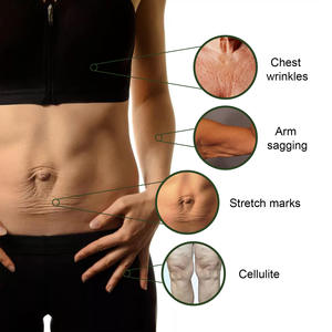 Offre Spéciale la texture et le teint de la peau Améliorant les niveaux de collagène revigorant Exfoliant pour le corps - Product Image 2