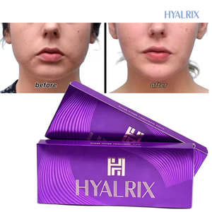 Prix de gros Hyalrix 1,1 ml – <span class=keywords><strong>Acide</strong></span> <span class=keywords><strong>Hyaluronique</strong></span> (HA) pour le lifting de la mâchoire, anti-rides et anti-âge - Product Image 3