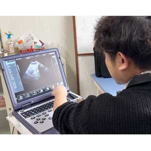 Ecógrafo Portátil Veterinario Dawei, Escáner de Ultrasonido para Perros, Máquina de Ultrasonido para Animales Pequeños - Product Image 3