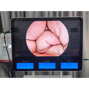 Shreek y tế Ent nội soi Máy ảnh 4K UHD nội soi đơn vị xách tay nội soi hysteroscope - Product Image 4