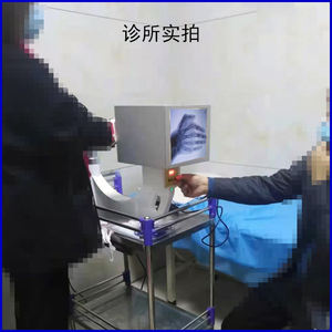 Hastane için 2024 sıcak satış tıbbi dijital taşınabilir floroskopi <span class=keywords><strong>x</strong></span> ışını makinesi - Product Image 6