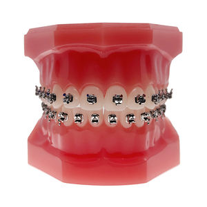 Orthodontische <span class=keywords><strong>Roth</strong></span> Beugels Actieve Zelf Ligating Beugels Voor 1G - Product Image 6
