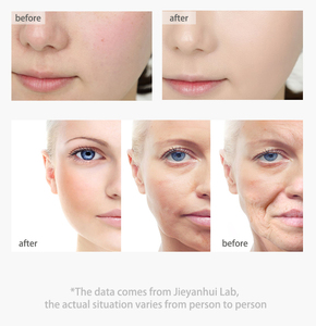 Crema y loción facial de etiqueta privada del proveedor, colágeno, blanqueamiento, eliminación de espinillas y acné - Product Image 3