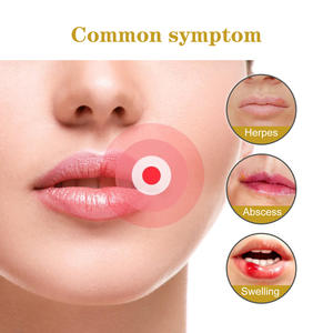 El Nuevo Parche para Herpes Bucal Está Diseñado para Aliviar la Hinchazón, las Ampollas y las Úlceras, y Es Fácil de Usar. - Product Image 3