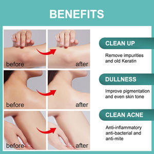 Nettoyant Corporel Naturel Parfumé aux Herbes et à l'Acide Salicylique – Gel Douche Antibactérien - Product Image 6