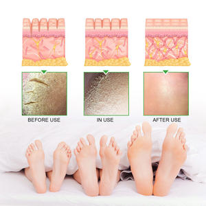 <span class=keywords><strong>Crema</strong></span> para Manos y Pies SOUTH MOON Hidratante, Reparadora, Nutritiva, Anti-Grietas, con 2% de Ácido Salicílico y 42% de <span class=keywords><strong>Urea</strong></span> - Product Image 3