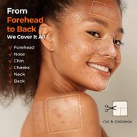 CSX Acné Guandong Patchs Hydrocolloïdes Blanchissants Personnalisés Vegan Acide Salicylique Soins du Visage Marque Privée Antibactérien Acné